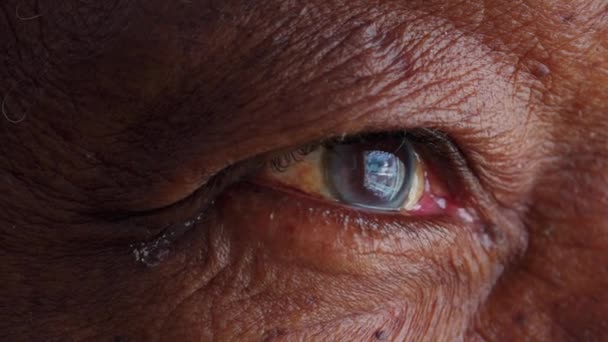 Крупный План Pensive Elderly Black Man Blue Eyes Looking Horizon — стоковое видео