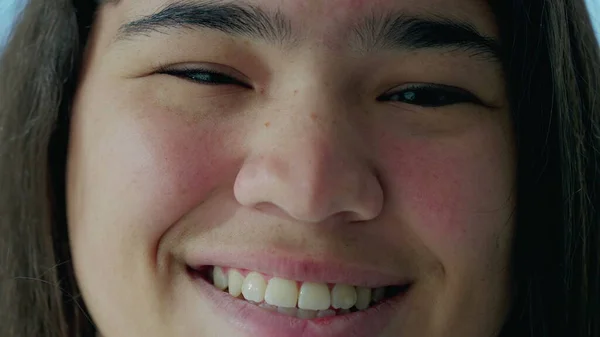 Radosne Oczy Młodej Azjatki Makro Zbliżenie Ujawnienie Szczegółów Różnorakim Uśmiechu — Zdjęcie stockowe