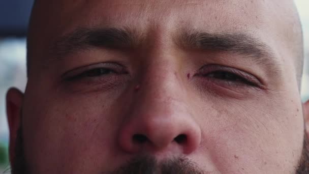 Erkeğin Yüzünün Makro Yakın Çekimi Yargılayıcı Fade Ciddi Üzgün Erkek — Stok video