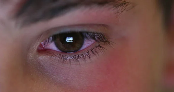 Boy Eye Staring Tablet Screen Playing Video Game Tech Macro — Stockfoto