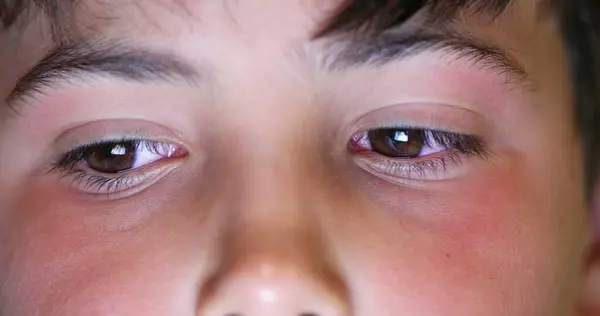 Boy Eyes Macro Close Watching Content Online Child Staring Blue —  Fotos de Stock