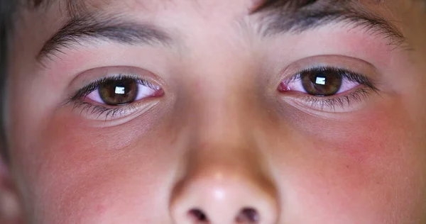 Boy Eyes Macro Close Watching Content Online Child Staring Blue — Photo