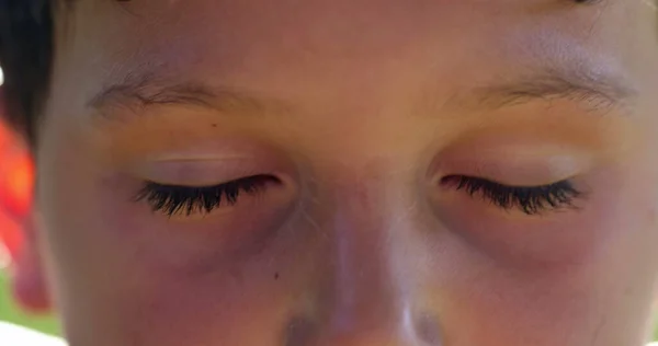 Child Eyes Closed Closeup Kid Opening Eye Surprise Shock — Photo