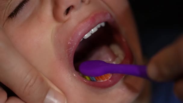 Brushing Child Teeth Tearful Kid While Parent Brushes Mouth Night — Stock Video
