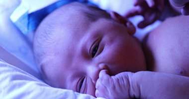 Newborn baby boy getting treated for jaundice under a phototherapy lamp