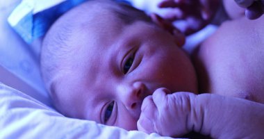 Newborn baby boy getting treated for jaundice under a phototherapy lamp