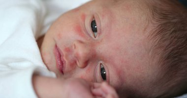 Newborn baby face with tired look