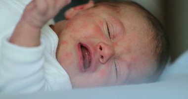 Newborn baby infant crying during first week of life, close-up of baby face
