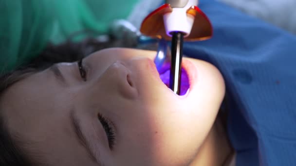 Laser Tandvård Närbild Barns Mun Tillämpa Laser Liten Flicka Tandläkare — Stockvideo