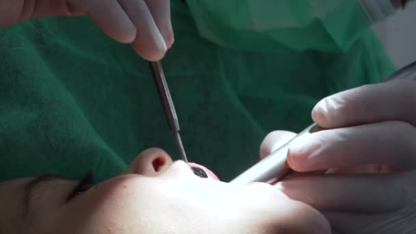 Close Boca Paciente Clínica Odontológica Dentista Tratando Saúde Oral Criança — Vídeo de Stock