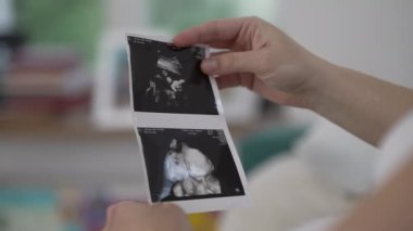 Annenin eli, doğmamış bebeğin ultrason görüntüsünü tutuyor. Annelik beklentisi.