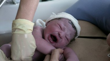 Yakın plan yeni doğan bebek doğumdan hemen sonra ilk kez ağlıyor. Bebekliğin ilk saniyeleri anne karnından cilt temasına dayanmış vaziyette ayrılır.