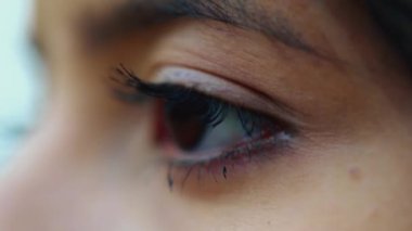 Gözünü kapatan kadının kaybı