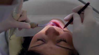 Diş tedavisi gören bir hastaya yakın çekim, özel aletlerle çalışan bir dişçi. Diş hekimi prosedürü dikkatlice uygularken hastalara ışık tutuluyor.