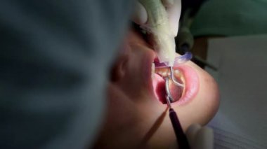 Hastaların diş tedavisi üzerinde çalışan dişçi, temiz ve modern bir klinik ortamında özel diş aletleri kullanmaya odaklanıyor