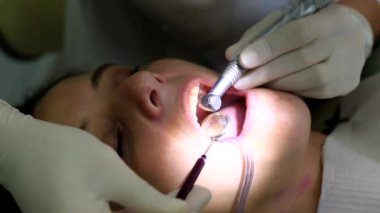 Diş tedavisi gören hastaya yakın çekim, özel aletler kullanan dişçi, oral bakım, hassas çalışma, profesyonel sağlık hizmetleri, diş sağlığı, klinikteki hasta
