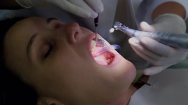 Diş hekimi, dişçi muayenesine odaklanır, hastaların ağızlarına temiz ve steril bir ortamda diş aletleriyle yaklaşır.