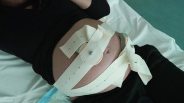 Prelabor 'daki Fetal Monitör Kayışlarıyla Hamile Göbeğinin Yakın Çekimi