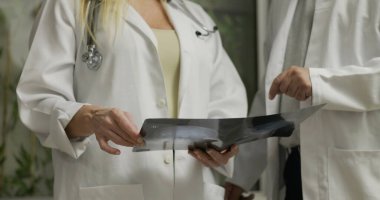 Doktorlar, hastane ortamında odaklanmış ifadeler ve işbirlikçi takım çalışmasıyla klinik teşhis sırasında röntgen sonuçlarını inceleyip tartışıyorlar.