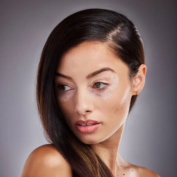 Skönhet Ansikte Och Vitiligo Med Modell Kvinna Studio Grå Bakgrund — Stockfoto