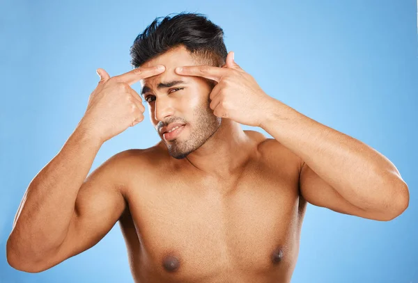 在自我护理 抗衰老治疗或面部清洁过程中 皮肤科 皮肤科和男性检查痤疮 粉刺或皱纹 有敏感皮肤病的保健 美容或健康人士 — 图库照片