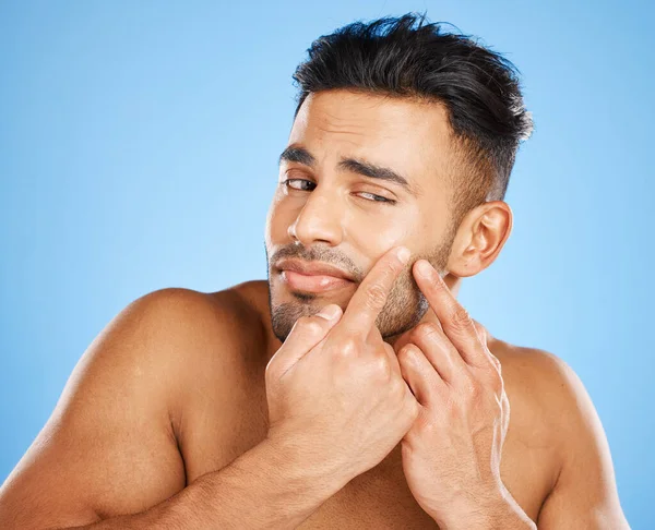 Skincare Beleza Modelo Verificar Acne Fuga Espinha Cicatriz Facial Após — Fotografia de Stock