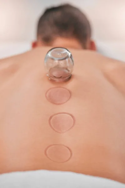 Wellness, man and cupping massage at spa for relief in stress, inflammation and back pain, healthcare and relax. Cupping therapy, back and guy in resort for alternative therapy, acupuncture and rest.