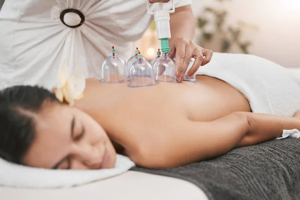 Relax, health and cupping with woman in spa for alternative medicine, healing and physiotherapy. Peace, wellness and consulting with patient and hands of massage therapist for zen, holistic or muscle.