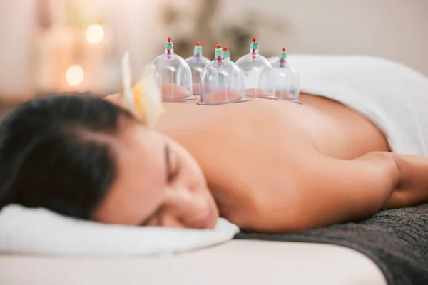 Spa, physiotherapy or cupping therapy woman for massage, back pain or luxury wellness medical help. Asian medicine, health or relax girl for zen, spiritual or stress healing therapy with vacuum cups.