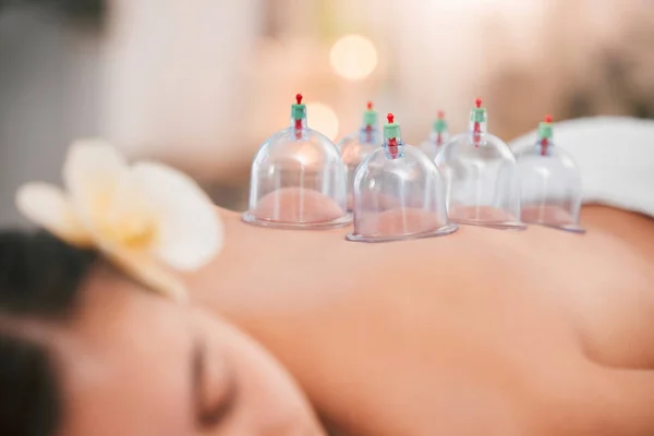 Cupping therapy, spa and zen woman for chinese alternative medicine treatment for back pain and health. Bodycare and wellness with cup therapy for stress relief, wellbeing wiith cups and heat on skin.