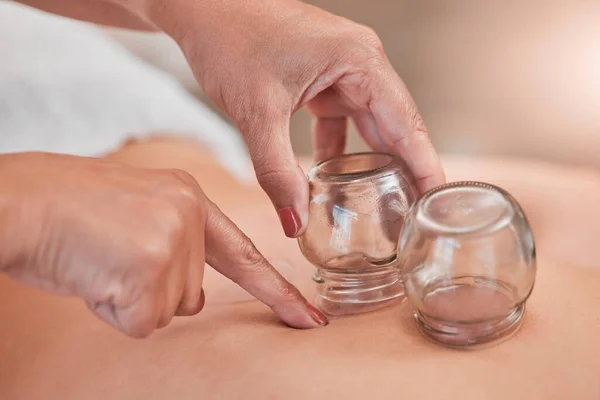 Cupping Thérapie Massage Dos Dans Spa Bien Être Santé Beauté — Photo