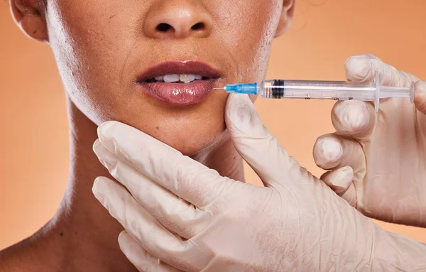 Vrouw Lippen Handen Voor Plastische Chirurgie Injectie Botox Huidverzorging Tegen — Stockfoto