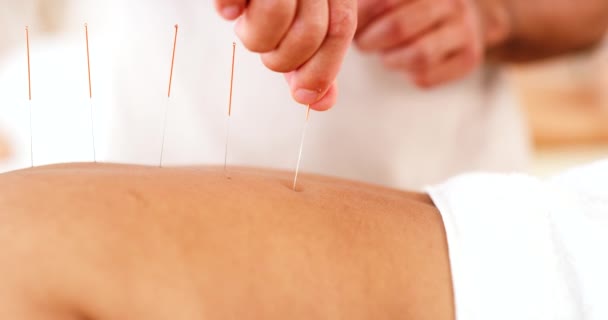Ręka Igły Akupunktura Luksusowe Spa Terapia Wellness Opieki Salonie Relaks — Wideo stockowe
