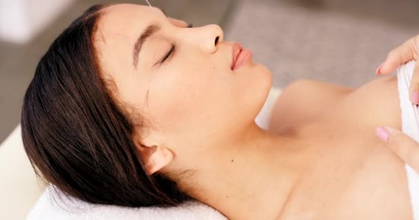 Akupunktur Wajah Dan Terapi Dengan Wanita Spa Untuk Menghilangkan Stres — Stok Video