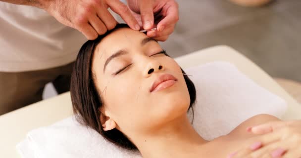 Beleza Relaxamento Acupuntura Rosto Mulher Com Agulha Mãos Terapeuta Medicina — Vídeo de Stock