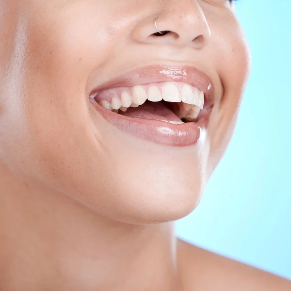 Bien Être Heureux Dents Femme Dentaire Avec Sourire Sain Hygiène — Photo