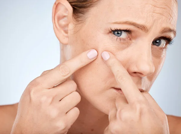 Gesundheit Hautpflege Und Frau Quetschen Akne Ins Gesicht Mit Studiohintergrund — Stockfoto