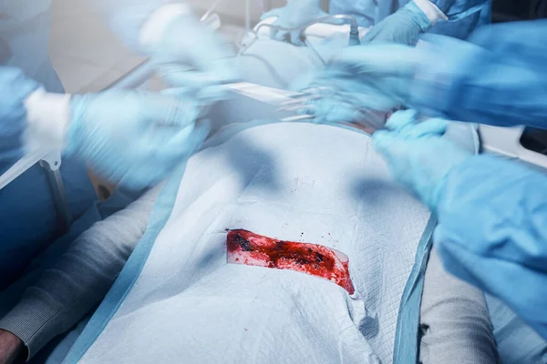Руки Кров Операція Командою Лікарів Роботі Під Час Операції Обладнанням — стокове фото