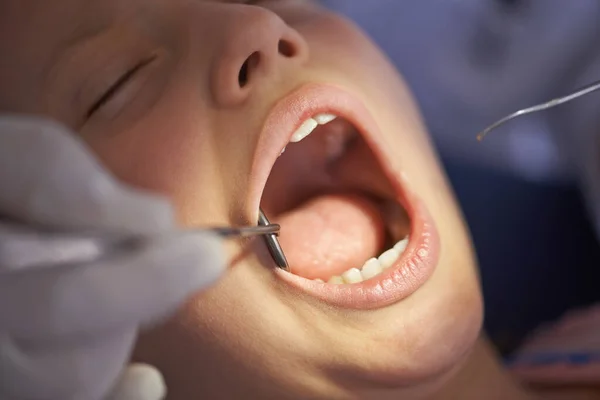 Just Checking Out Your Pearly Whites Closeup Shot Dentist Performing — Foto Stock
