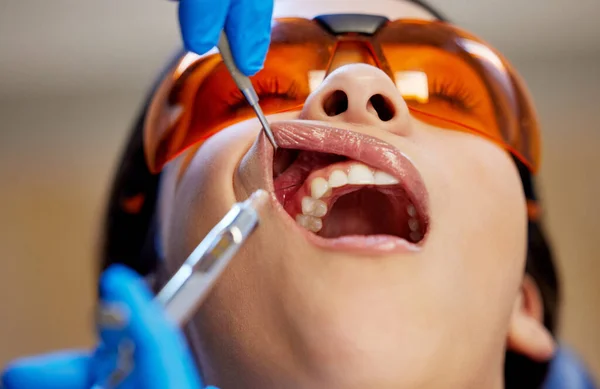 Better Technique More Youll Beaming Young Woman Having Dental Procedure — Foto Stock