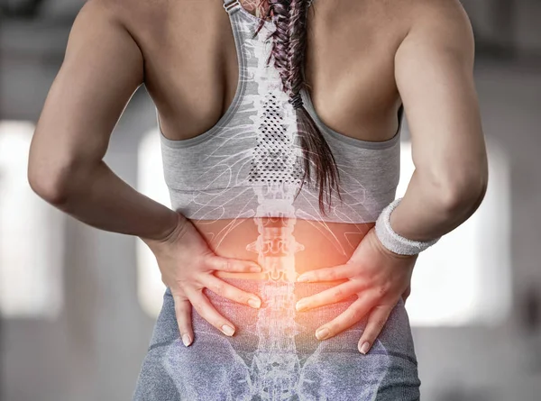 Spine, anatomy and back of a woman with pain during fitness, training and exercise with a problem. X ray, medical and athlete with injury or accident from gym sports, workout or cardio inflammation.