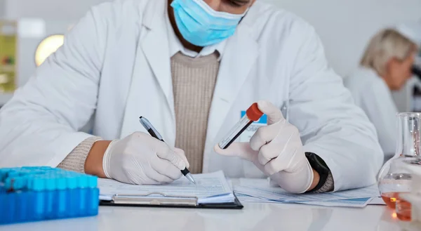 Science, writing and man in laboratory with blood sample for dna results, medical report and research. Biotechnology, health and scientist write notes for data analytics, analysis and investigation.