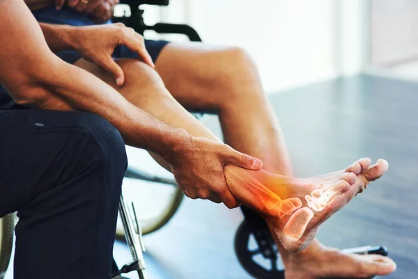Rehabilitation, physiotherapist and help a patient with foot injury, pain and muscle tension recovery. Physiotherapy, male or doctor assist with strain, movement or wellness with person in wheelchair.