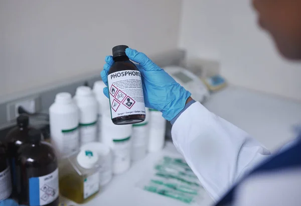 Hand Science Phosphorus Doctor Working Lab Chemicals Experiment Reaction Medical —  Fotos de Stock
