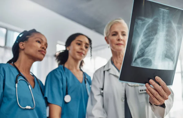 Xray, doctor and nurses, team and medicine with analysis of lung scan and cardiology medical group. Surgeon, collaboration and results with healthcare, focus with health and prepare for surgery.