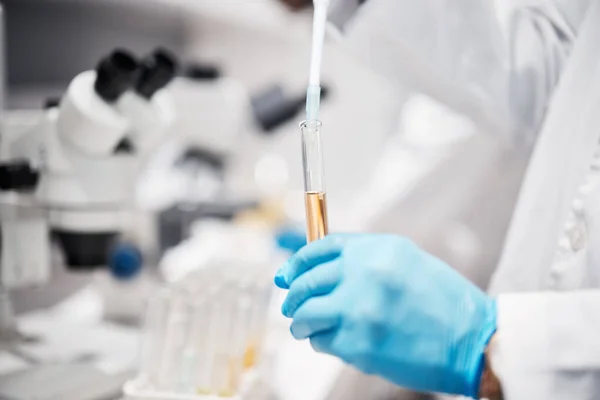 Ręce Nauka Rurka Badań Laboratorium Płynem Lekiem Lub Produktem Farmaceutycznym — Zdjęcie stockowe