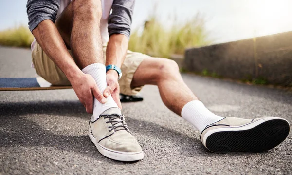Fitness, athlete and man with ankle injury, pain or accident while skateboarding in the street. Sports, exercise and male skateboarder with muscle sprain, medical emergency or injured leg in the road.
