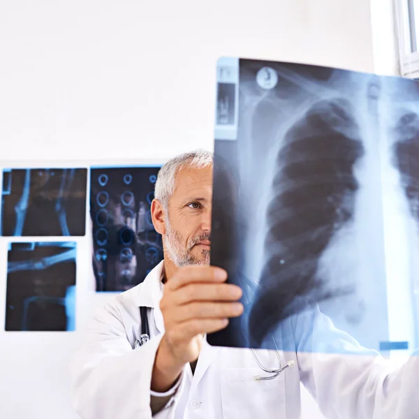 Давайте Подивимося Чому Проблема Зрілий Чоловік Лікар Дивиться Рентгенівське Зображення — стокове фото