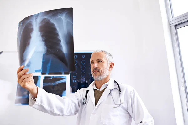 得到正确的诊断 在医院里看X光照片的成熟的男医生 — 图库照片