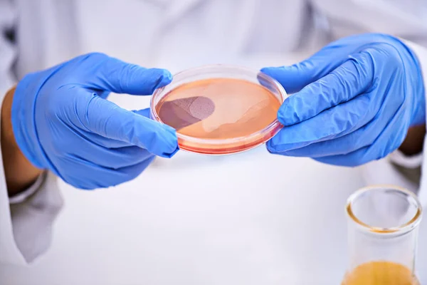 細菌が何をしているか見てみましょう 実験中にペトリ皿を持っている科学者の閉鎖ショット — ストック写真